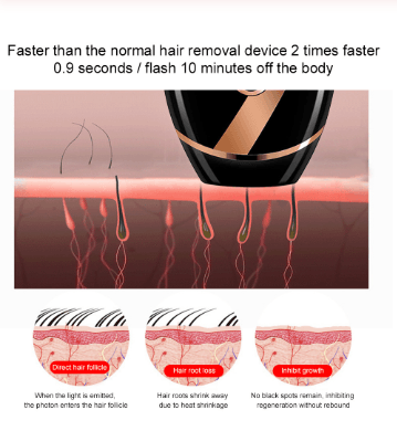 Laser Hair Removal Machine